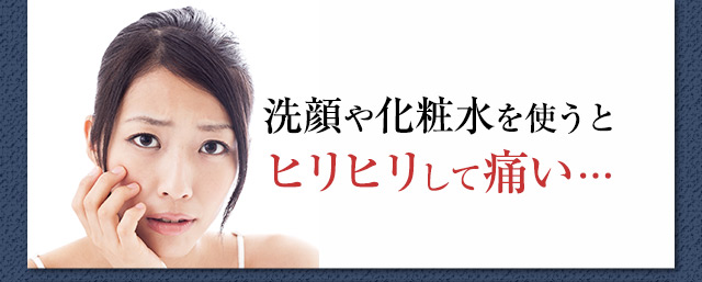 洗顔や化粧水を使うとヒリヒリして痛い…